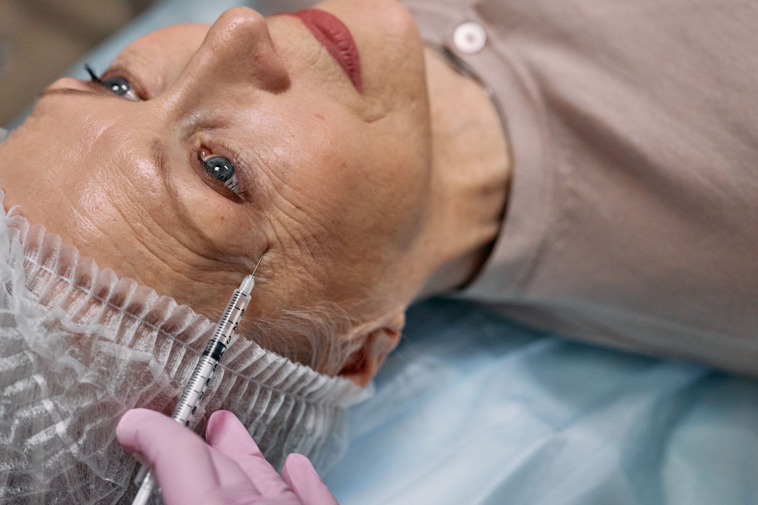 PRP + Laser CO2: combinação para rejuvenescimento facial - Dra. Rubia de Carli
